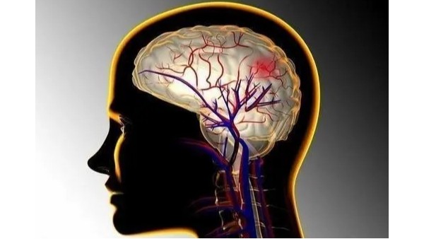 脑血栓形成可以并发哪些疾病？