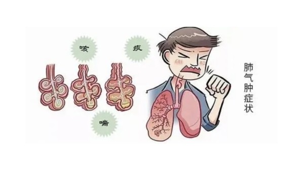 肺气肿患者要禁忌哪些饮食！